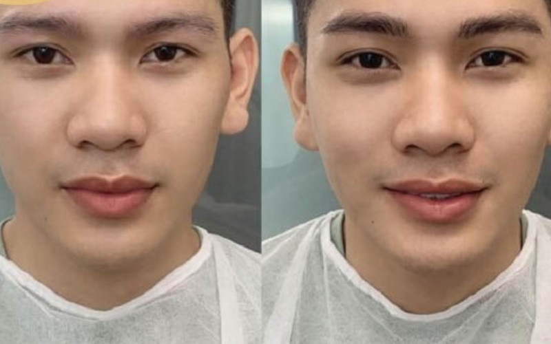 Đàn ông có thể cải thiện tướng lông mày xấu bằng cách chăm sóc, chỉnh sửa dáng mày