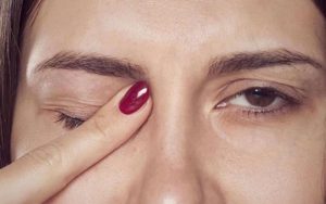 Giật lông mày phải nữ có ý nghĩa gì? Nguyên nhân và cách khắc phục