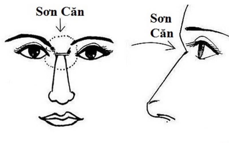 Lông mày chữ nhất sơn căn