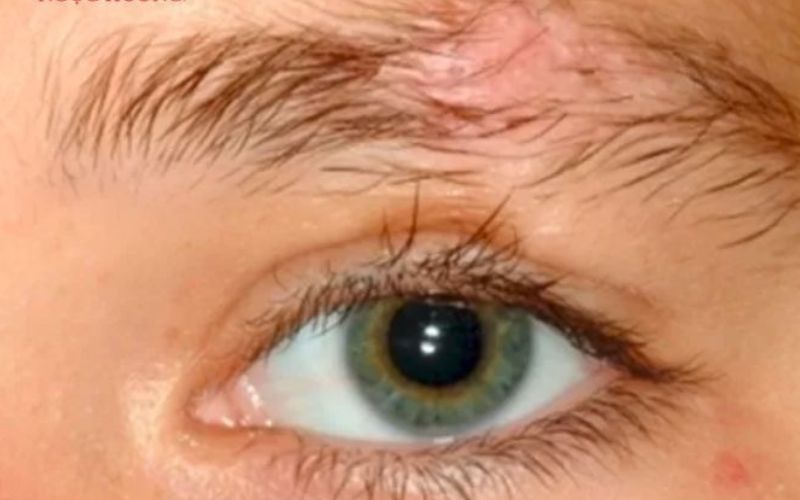 Lông mày ngắn xoắn ốc