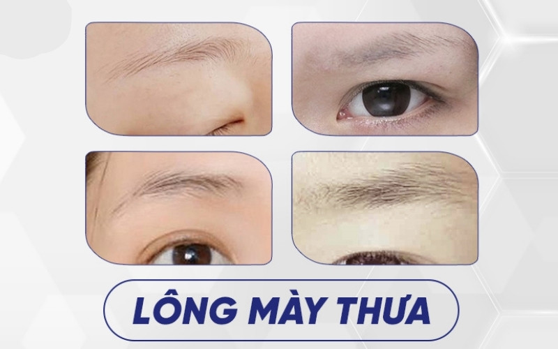 Lông mày thưa là dáng mày có mật độ sợi lông ít, mọc không đều
