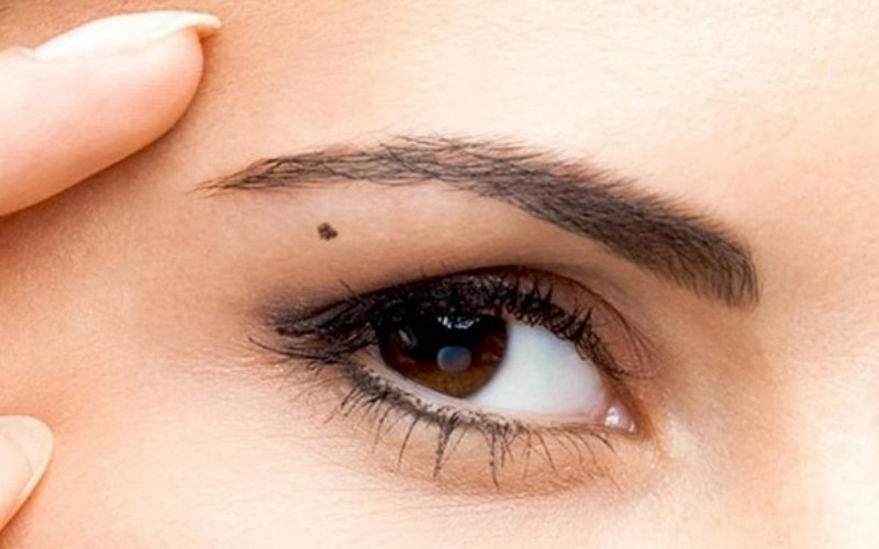Việc có nên xóa nốt ruồi đuôi lông mày hay không còn tùy thuộc vào mục đích thẩm mỹ