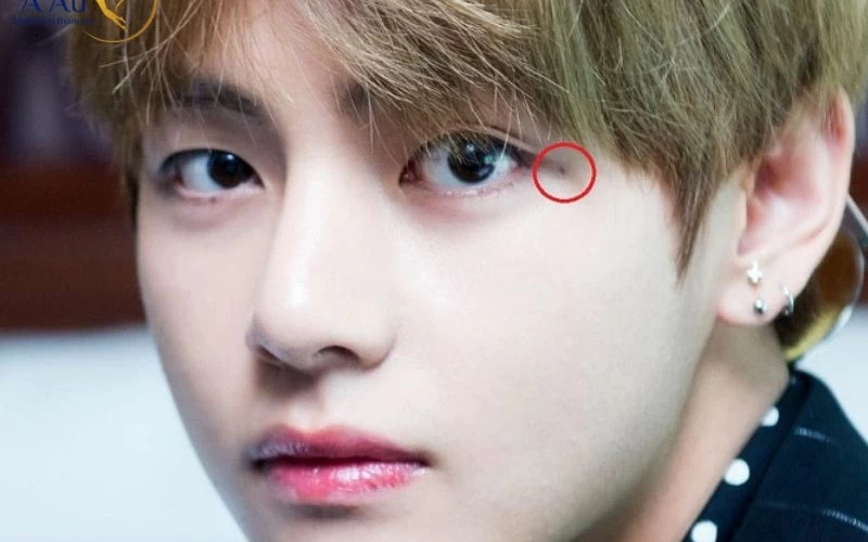 Nốt ruồi son ở lông mày nam giới thường tượng trưng cho sự thịnh vượng