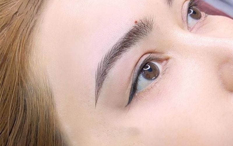 Những nốt ruồi may mắn không nên xoá