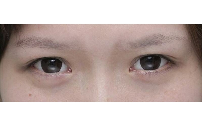 Tướng lông mày đàn ông bị đứt đoạn thường cho thấy cuộc sống dễ gặp trở ngại