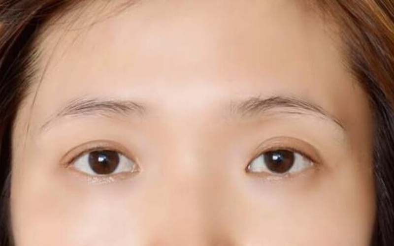 Lông mày thưa ở nữ khiến khuôn mặt thiếu điểm nhấn và trông nhợt nhạt
