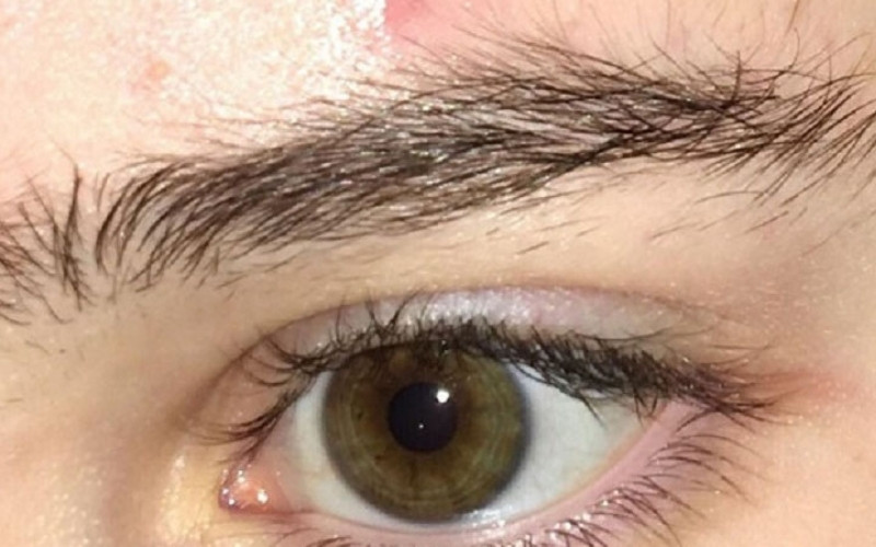 Lông mày mọc không theo quy tắc khiến khuôn mặt kém gọn gàng