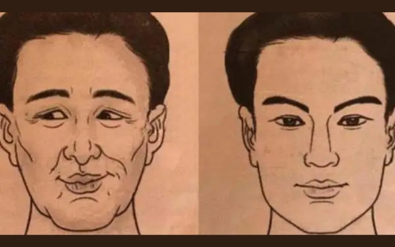 Xương lông mày nhô cao tạo nét góc cạnh và cứng rắn cho khuôn mặt