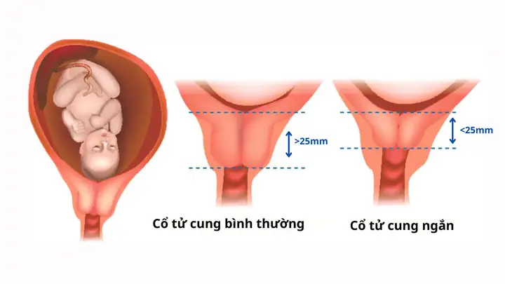 Khi Ra Tù Mình Nên Cúng Kiếng Như Thế Nào Khi Ra Tù Mình Nên Cúng Kiếng Như Thế Nào